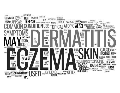 Guidelines For Management And Treatment Of Ad With Phototherapy And Systemic Agents Eczema